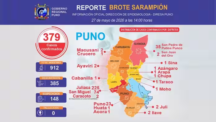 Puno reporta 379 casos de sarampión y Juliaca concentra la mayor cifra