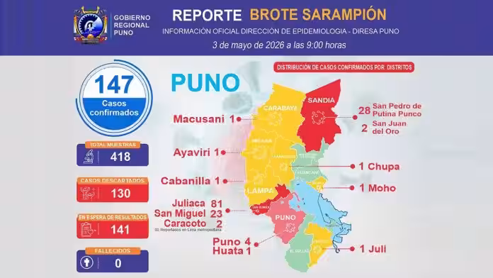 Sarampión en Puno sube a 147 casos y Juliaca concentra 81 contagios