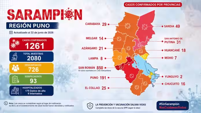 Sarampión en Puno: Reportan 1.261 casos confirmados en la región